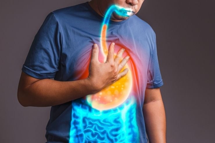 does-acid-reflux-cause-gi-cancer